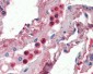 LF / LTF / Lactoferrin Antibody (Internal)